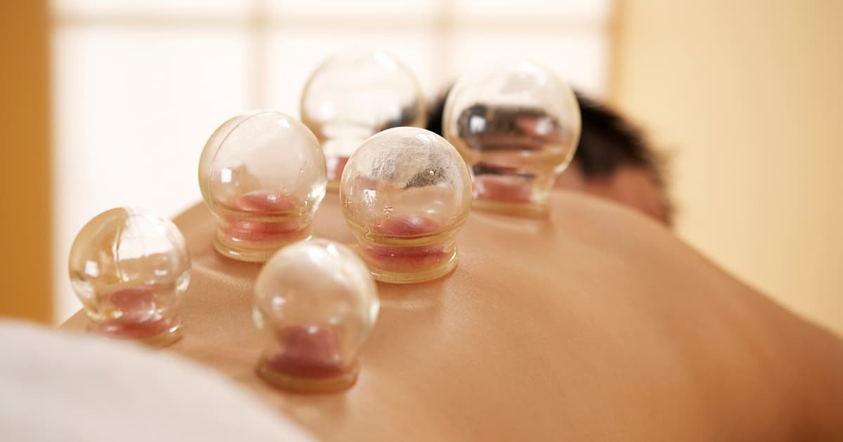 Cupping
